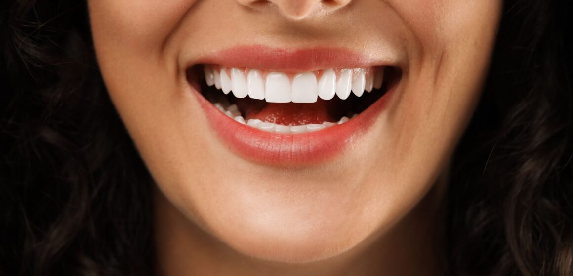 Sorriso branco no verão: 5 mitos e verdades sobre clareamento dental